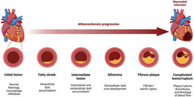 Posing the rationale for synthetic lipoxin mimetics as an adjuvant treatment to gold standard atherosclerosis therapies